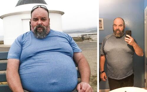 Photo Before and after Keto Probiotix Course, experience of using capsules with a Venice miger